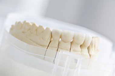 Alçı model üzerinde seramik Köprüsü