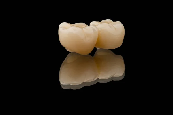 2つの臼歯の歯の橋 ブラックガラスの背景に隔離された金属フリーセラミック歯冠のクローズアップ写真 インプラントで歯の回復 歯の概念写真 義歯学 — ストック写真