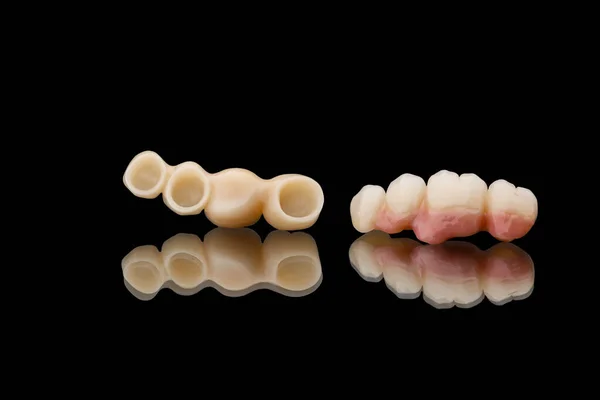 Two dental bridges of four teeth. Close-up photo of ceramic teeth crowns isolated on black glass background. Tooth recovery with implant. Dentistry conceptual photo. Prosthetic dentistry. — Stock Photo, Image