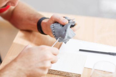 Diş modelinin mini vida modeli ile dişçi alıştırması. Ortodonti dişçiliği. Takma diş.