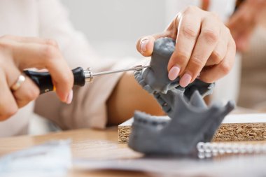 Diş modelinin mini vida modeli ile dişçi alıştırması. Ortodonti dişçiliği. Takma diş.
