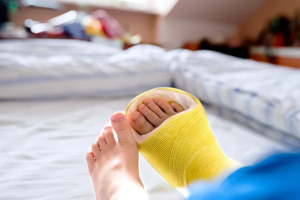 Junge mit gebrochenem Bein im Gips — Stockfoto