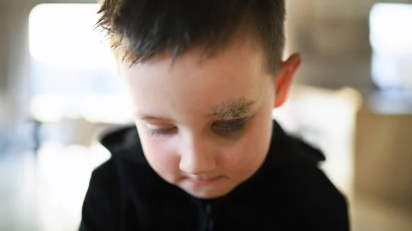 Pobre niño triste con la ceja cortada de pie en casa, concepto de pobreza. —  Fotos de Stock