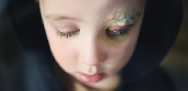 Close-up de menino pequeno triste com sobrancelha cortada em casa, conceito de pobreza. — Fotografia de Stock