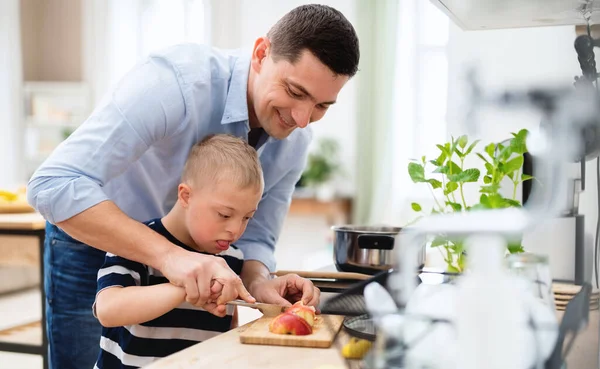 Padre con síndrome de Down feliz hijo en el interior de la cocina, picando manzana. —  Fotos de Stock