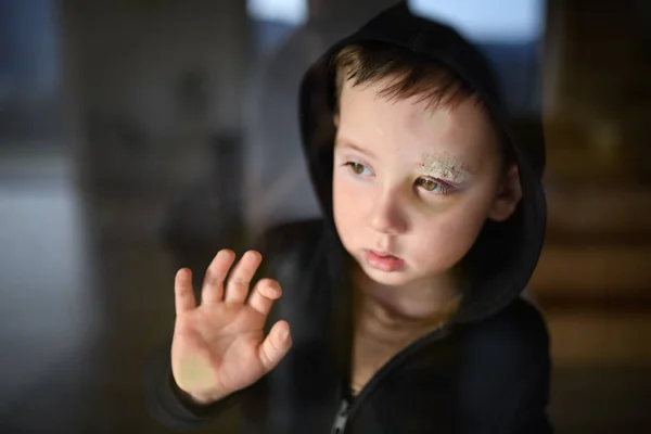 Pobre menino pequeno triste com sobrancelha cortada em casa, conceito de pobreza. — Fotografia de Stock