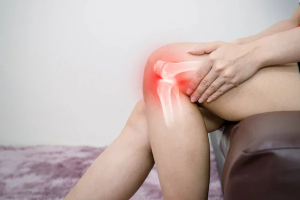 Osteoartrite Perna Humana Inflamação Articulação Óssea — Fotografia de Stock