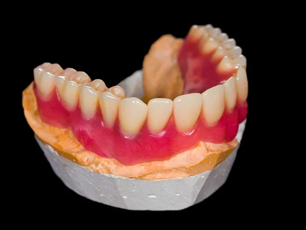 Dentadura inferior — Fotografia de Stock