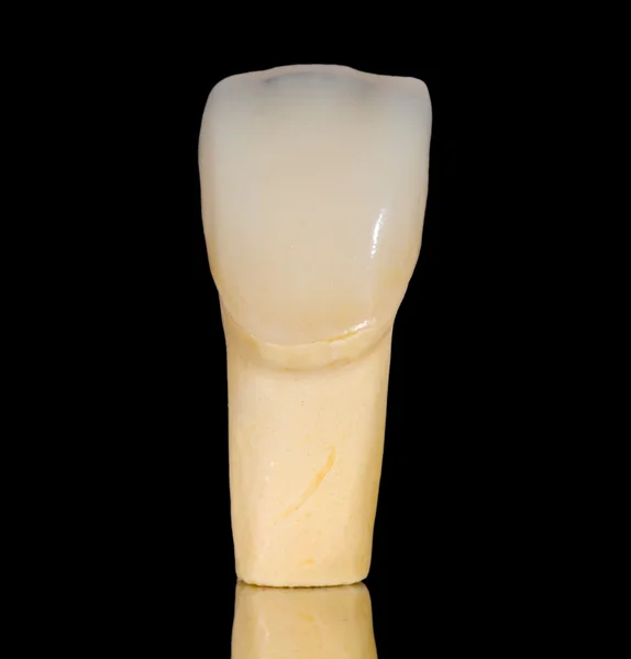 Dental ceramic crown — Stock Photo, Image