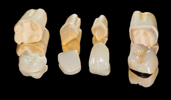 Dental ceramic crowns — Stock Photo, Image