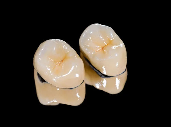Corone dentali in ceramica — Foto Stock