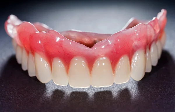 Denture — Stock Photo, Image