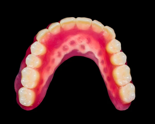 Dentiera inferiore — Foto Stock