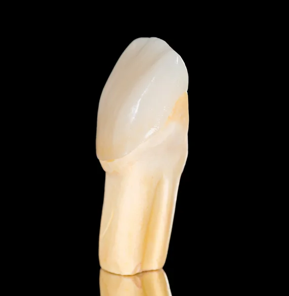 Coroa de cerâmica dentária — Fotografia de Stock