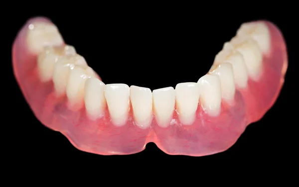 Dentiera inferiore — Foto Stock