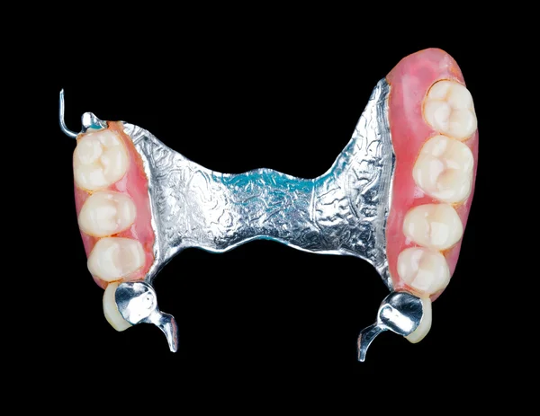 Removable dental prosthesis — Stock Photo, Image