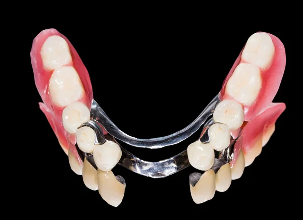 Prótese dentária removível — Fotografia de Stock