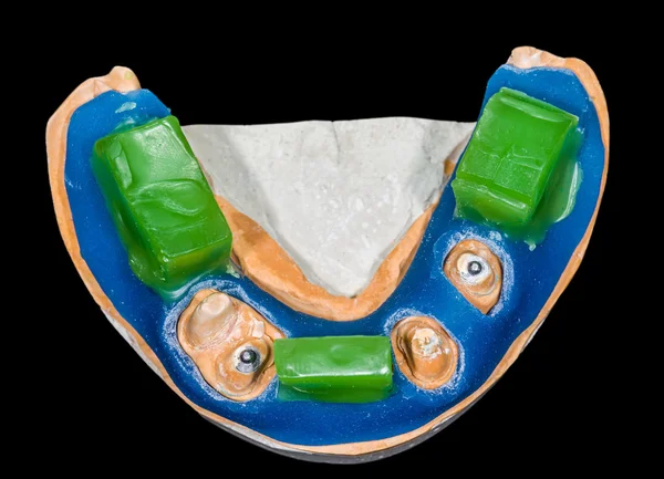 Dental bite registration model — Stock Photo, Image