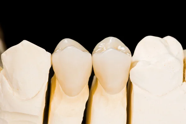 Ceramic crowns — Stock Photo, Image