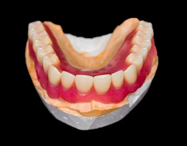 Dentiera inferiore — Foto Stock