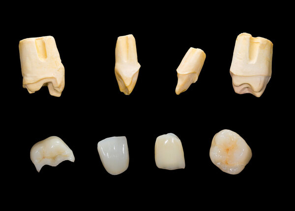 Dental ceramic crowns