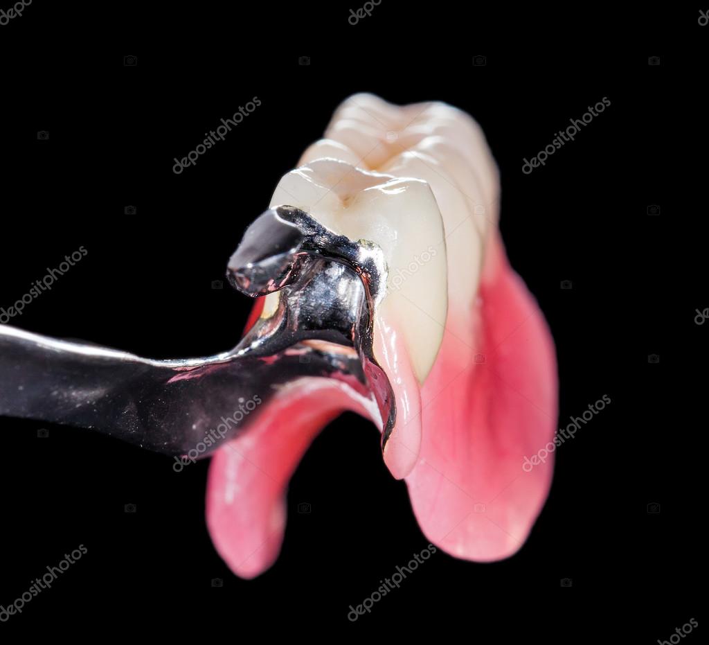 Removable dental prosthesis Stock Photo by ©obencem 53549251