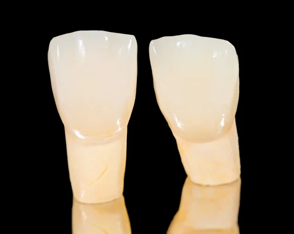 Ceramiczne korony dentystyczne — Zdjęcie stockowe