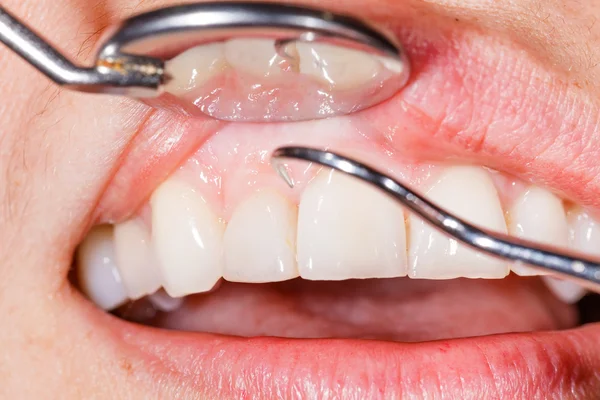 Examen dental — Foto de Stock