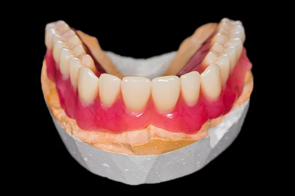Lower denture — Stock Photo, Image