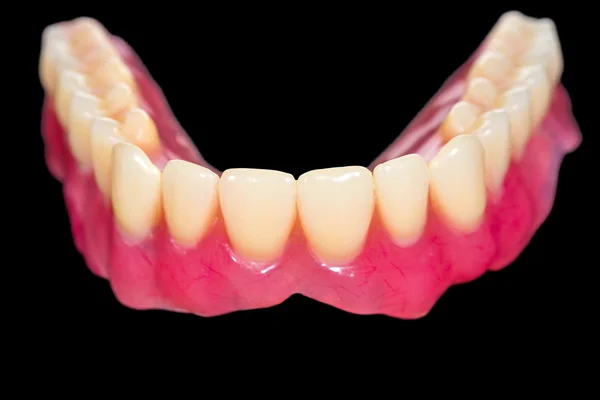 Dentadura inferior — Fotografia de Stock