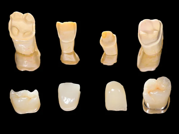 Coroas de cerâmica dentária — Fotografia de Stock