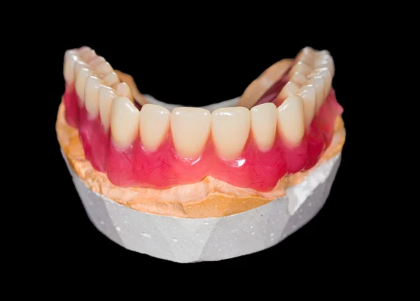 Lower denture — Stock Photo, Image