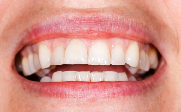 Hermosa sonrisa —  Fotos de Stock