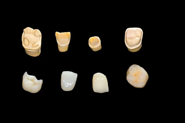 Corone dentali in ceramica — Foto Stock