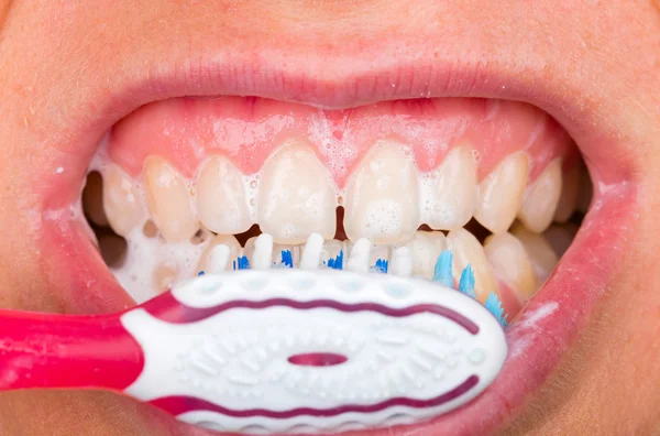 Cepillado de dientes —  Fotos de Stock