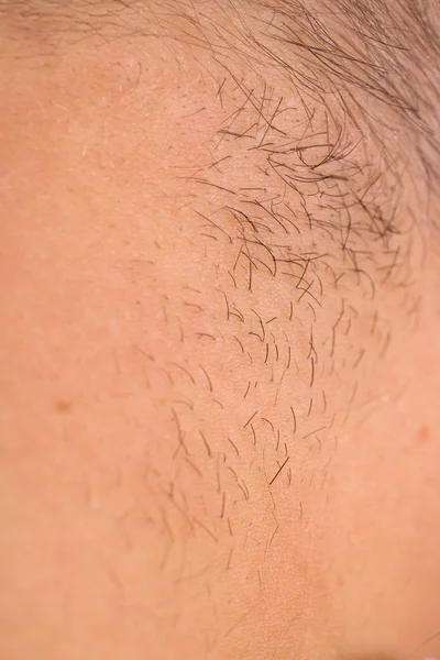 Close up of human skin — Stock Photo, Image