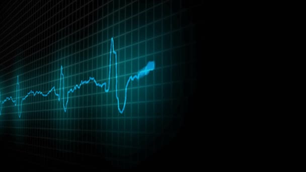 cardiogramme coeur malade. Le concept de santé 