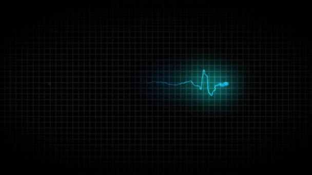Кардиограмма больного сердца — стоковое видео