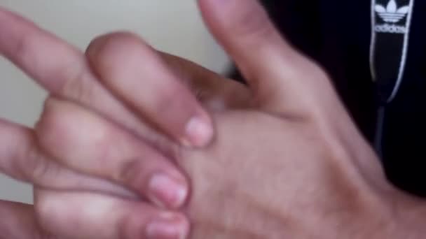Man Cracking Finger Knuckles Joints — Stock Video