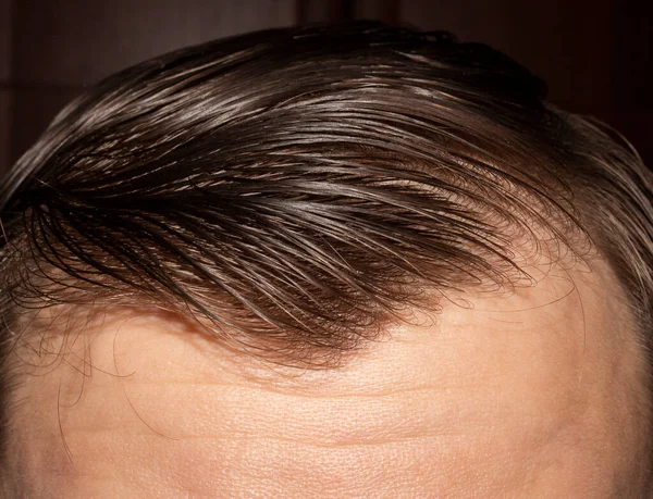 Vlhké Česané Vlasy Tmavovlasé Pozadí Řídké Hnědé Vlasy Mužů — Stock fotografie