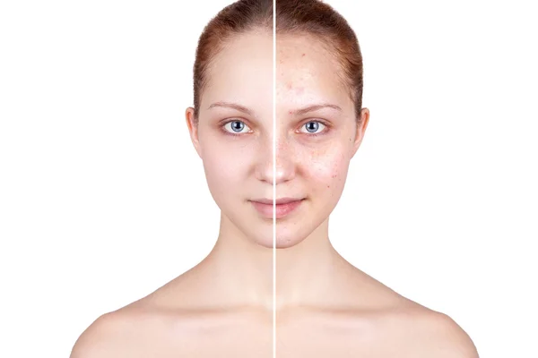 Befor ve tedaviden sonra.