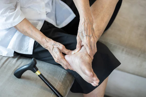 Viejo Anciano Con Lesiones Los Pies Dolor Talón Enfermedades Del — Foto de Stock