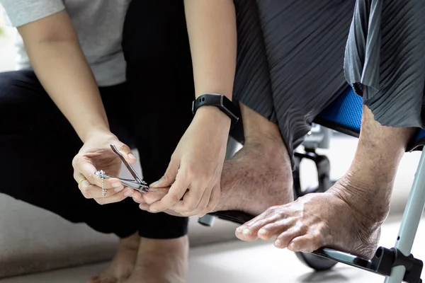 Nahaufnahme Weibliche Hand Hält Einen Nagelschneider Schneiden Des Eingewachsenen Nagels — Stockfoto