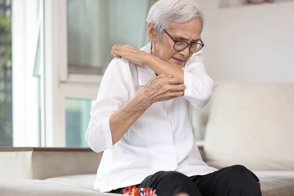 Juckende Seniorin Kratzt Sich Arm Ursachen Für Juckreiz Durch Mücken — Stockfoto