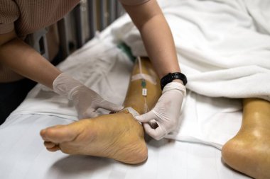 Hemşirenin elleri hastaya bacağına tuz çözeltisi vererek ya da bileğindeki şişlik nedeniyle bileğine trombosit vermek için iğne vererek hastanede yatmasına yardım ediyor.