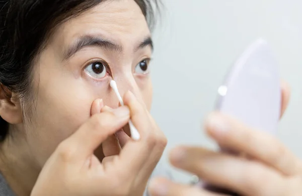 Asian woman has eye pain,irritation problem from dust,insect or eyelash falling into the eyes,girl removing dirt using a cotton bud swab to wipe clean the itchy area or treating a sore eye,health care