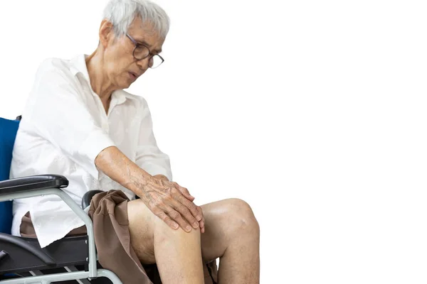 Нога Старшої Жінки Яка Болить Колінних Суглобах Біль Кістці Біль — стокове фото
