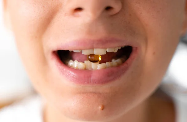 Primer plano de la boca de la mujer con cápsula vitamínica. Micro dosificación para el tratamiento de la depresión. Vitaminas y suplementos medicina preventiva —  Fotos de Stock