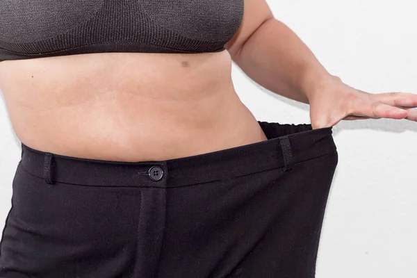 Μια Γυναίκα Στη Διαδικασία Του Βάρους Απώλεια Δείχνει Μεγάλα Παντελόνια — Φωτογραφία Αρχείου