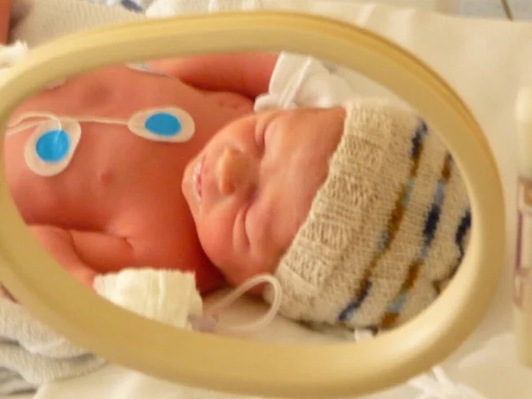 Μωρό Ηλεκτρόδια Θερμοκοιτίδα Πλεκτό Καπάκι Εικόνα Αρχείου